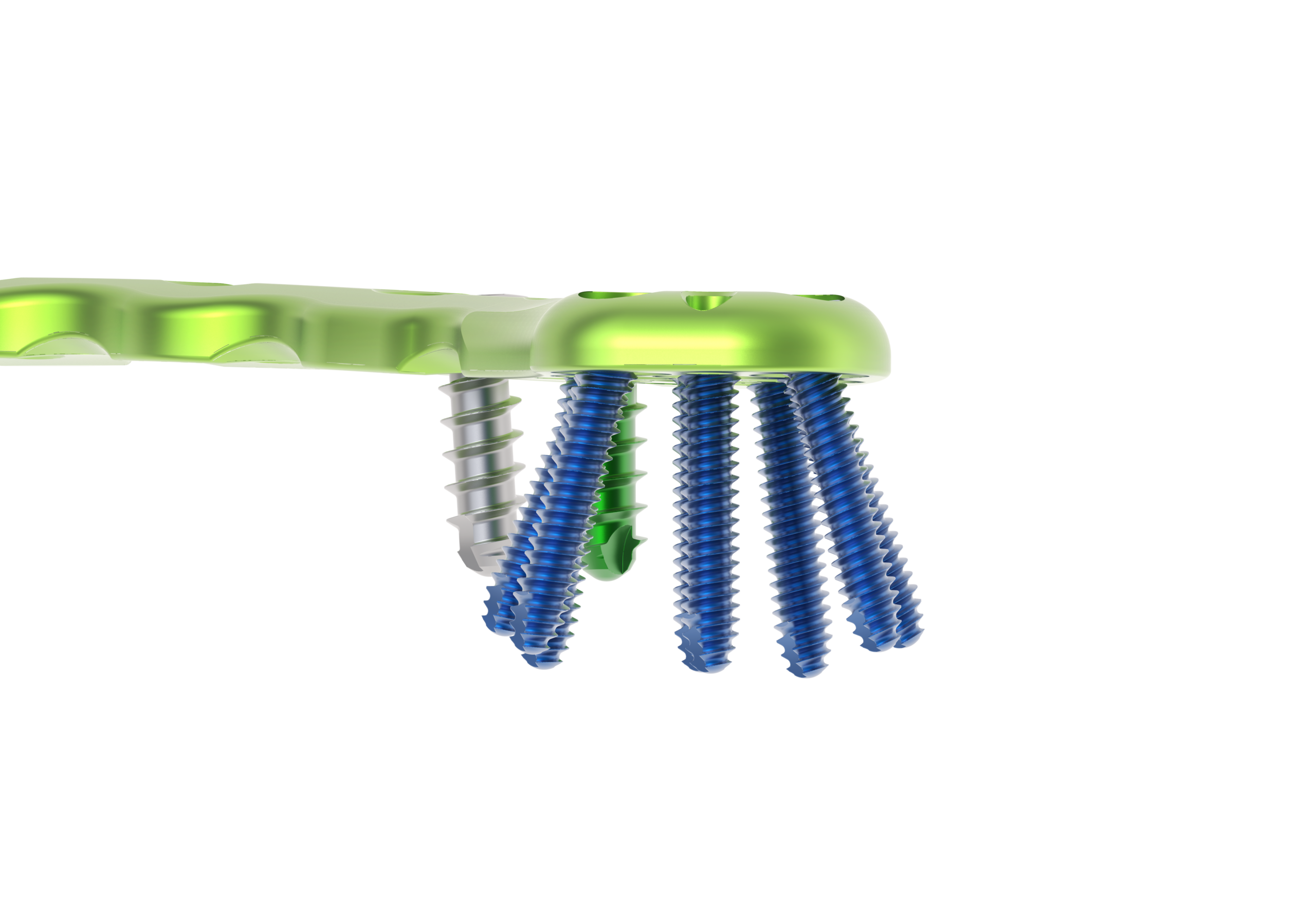 Imagem 5 - Clavicle_Lateral Plates_4 (Drive)
