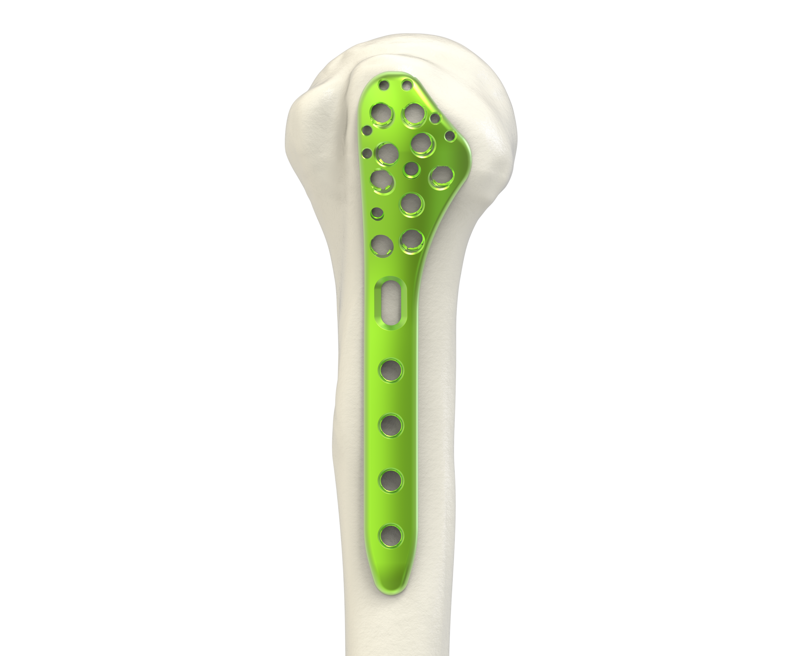 Imagem 2 - Humerus_Surgical Technique_1-1 (Drive)